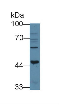 Western Blot; Sample: Recombinant protein.