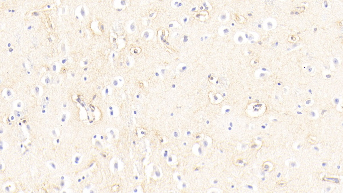 DAB staining on fromalin fixed paraffin-embedded Kidney tissue)