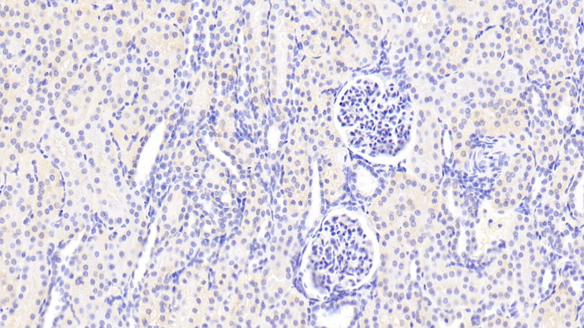 Activin A Receptor Type I B (ACVR1B) Polyclonal Antibody - image 5