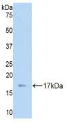 Laminin Gamma 3 (LAMC3) Polyclonal Antibody - image 2