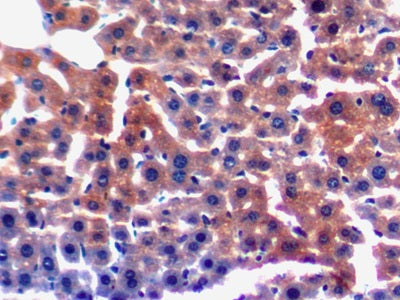 Laminin Gamma 3 (LAMC3) Polyclonal Antibody - image 4