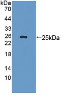 DAB staining on IHC-P; Samples: Mouse Kidney Tissue; Primary Ab: 10µg/ml Rabbit Anti-Mouse LAMb3 Antibody Second Ab: 2µg/mL HRP-Linked Caprine Anti-Rabbit IgG Polyclonal Antibody