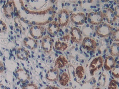 DAB staining on IHC-P; Samples: Mouse Testis Tissue.
