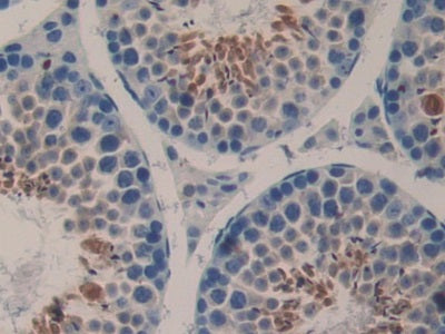 Laminin Beta 3 (LAMb3) Polyclonal Antibody - image 5