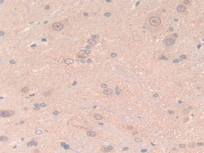DAB staining on fromalin fixed paraffin- embedded brain tissue)