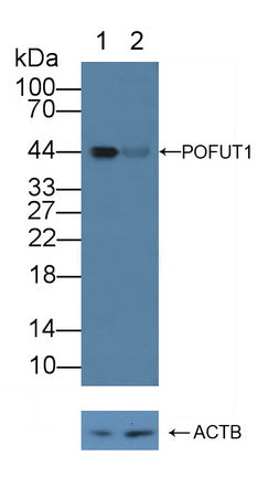 DAB staining on IHC-P; Samples: Human Liver Tissue; Primary Ab: 20µg/ml Rabbit Anti-Human POFUT1 Antibody Second Ab: 2µg/mL HRP-Linked Caprine Anti-Rabbit IgG Polyclonal Antibody