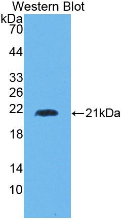 Western Blot; Sample: MCF7 cell lysate; Primary Ab: 2μg/ml Rabbit Anti-Human HMMR Antibody; Second Ab: 0.2µg/mL HRP-Linked Caprine Anti-Rabbit IgG Polyclonal Antibody;
