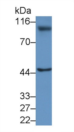 Hyaluronan Mediated Motility Receptor (HMMR) Polyclonal Antibody - image 3