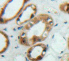 Fibroblast Growth Factor Receptor Substrate 2 (FRS2) Polyclonal Antibody - image 4