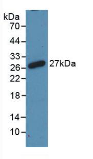 DAB staining on IHC-P; Samples: Rat Lung Tissue; Primary Ab: 20µg/ml Rabbit Anti-Rat RANk Antibody Second Ab: 2µg/mL HRP-Linked Caprine Anti-Rabbit IgG Polyclonal Antibody