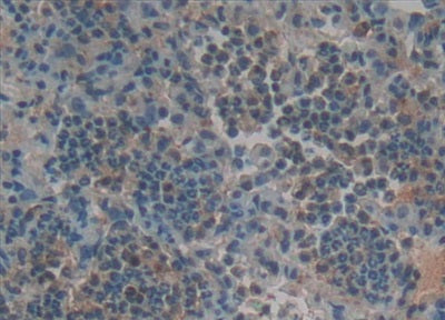 DAB staining on IHC-P; Samples: Rat Uterus Tissue.