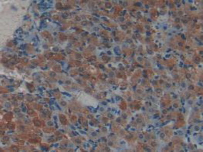 Receptor Activator Of Nuclear Factor Kappa B (RANk) Polyclonal Antibody - image 5