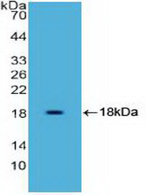 FITC staining on IF; Samples: Human HepG2 cell;  Primary Ab: 20μg/ml Rabbit Anti-Human HMGA1 Antibody Second Ab: 1.5μg/ml FITC-Linked Caprine Anti-Rabbit IgG Polyclonal Antibody