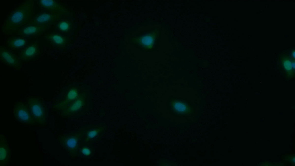High Mobility Group AT Hook Protein 1 (HMGA1) Polyclonal Antibody - image 4