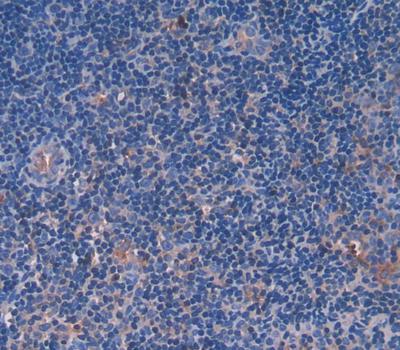 Ki-67 Protein (Ki-67) Polyclonal Antibody - image 3