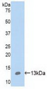 Western Blot; Sample: Human A549 cell lysate; ; Primary Ab: 2µg/ml Rabbit Anti-Human S100A10 Antibody; Second Ab: 0.2µg/mL HRP-Linked Caprine Anti-Rabbit IgG Polyclonal Antibody;
