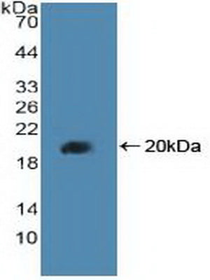 Peroxisome Proliferator Activated Receptor Delta (PPARd) Polyclonal Antibody - image 3