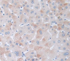 Peroxisome Proliferator Activated Receptor Delta (PPARd) Polyclonal Antibody - image 4