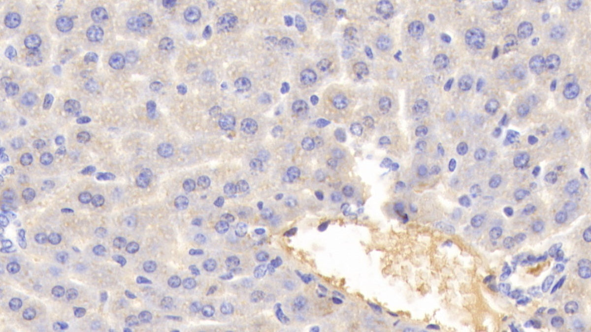 DABstainingonIHC-P.Samples:MouseTissue)