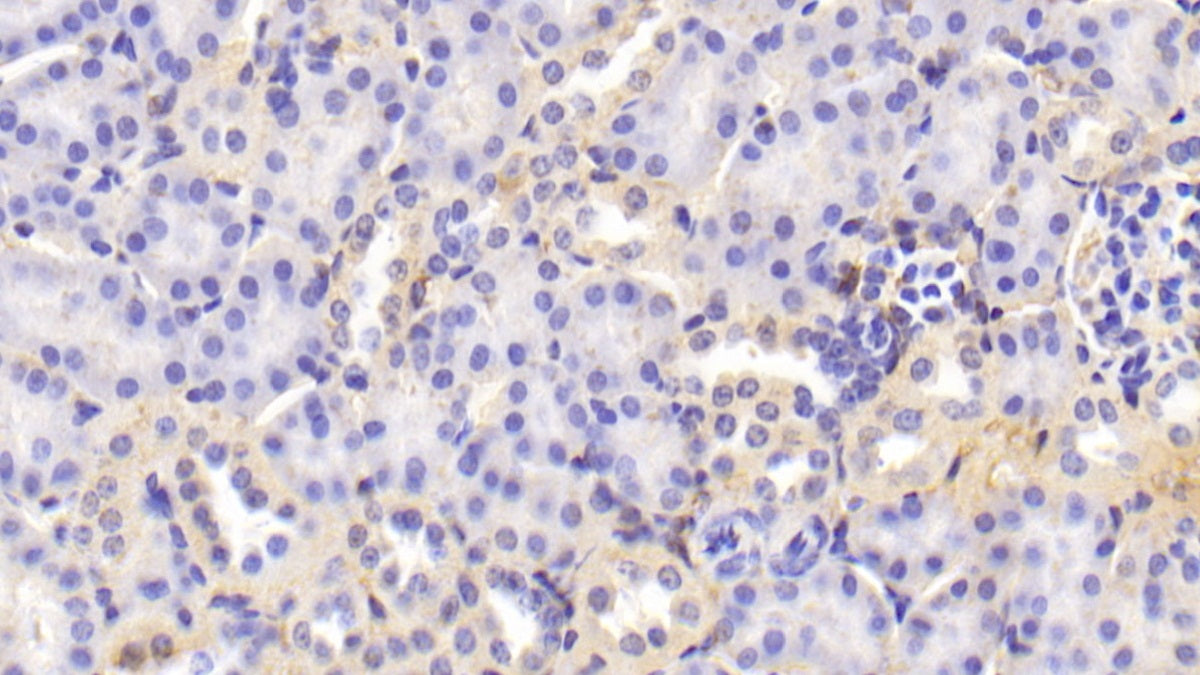 Transferrin (TF) Polyclonal Antibody - image 5