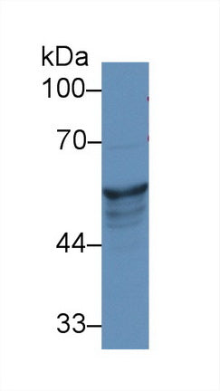 Western Blot; Sample: Recombinant protein.