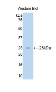 Cytokeratin 8 (CK8) Polyclonal Antibody - image 3