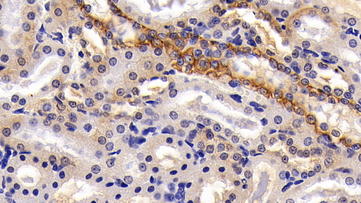 Cytokeratin 8 (CK8) Polyclonal Antibody - image 4