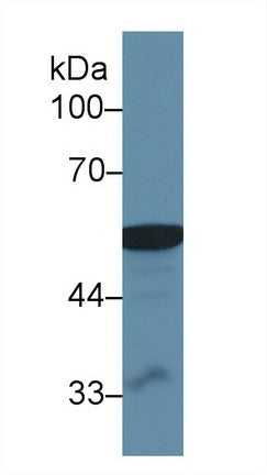 Western Blot; Sample: Recombinant protein.