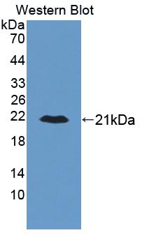DAB staining on IHC-P; Samples: Human Liver Tissue;  Primary Ab: 20µg/ml Rabbit Anti-Human ALDM Anti