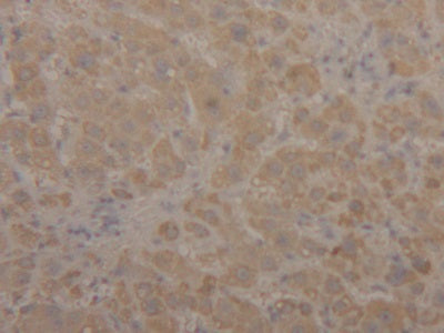 DAB staining on IHC-P; Samples: Human Liver Tissue)