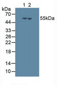 Western Blot; Sample: Recombinant S17aH, Human.