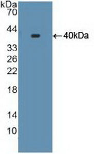 FITC staining on IF; Samples: Human HepG2 cell;  Primary Ab: 20μg/ml Rabbit Anti-Human S17aH Antibody Second Ab: 1.5μg/ml FITC-Linked Caprine Anti-Rabbit IgG Polyclonal Antibody