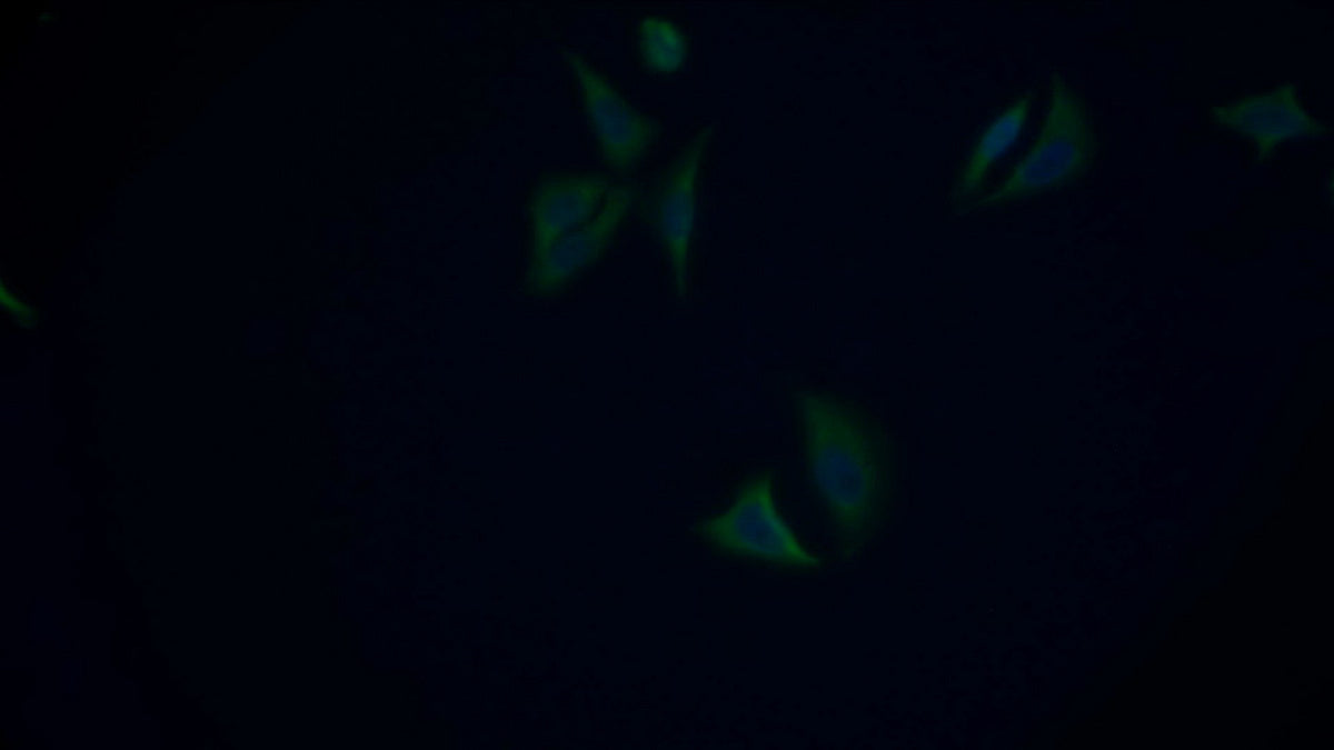 Cytochrome P450 17A1 (CYP17A1) Polyclonal Antibody - image 4