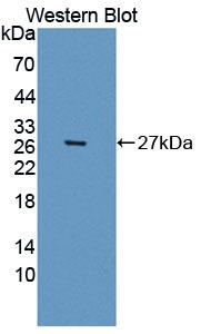 Xeroderma Pigmentosum, Complementation Group D (XPD) Polyclonal Antibody - image 2