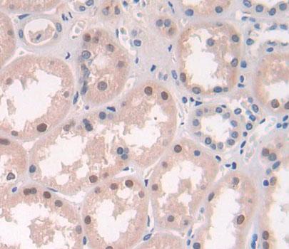 Xeroderma Pigmentosum, Complementation Group D (XPD) Polyclonal Antibody - image 3