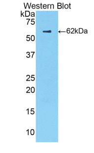 Complement Factor B (CFB) Polyclonal Antibody - image 2