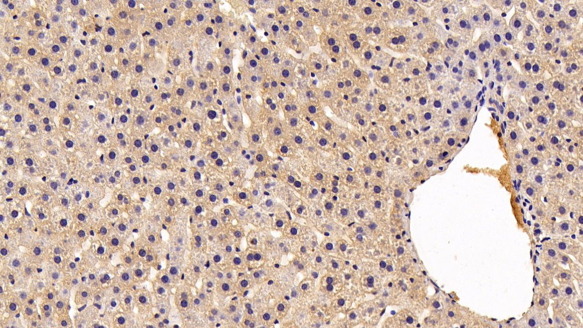 Complement Factor B (CFB) Polyclonal Antibody - image 3