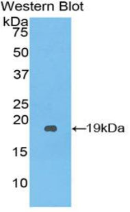 Serpin A10 (SERPINA10) Polyclonal Antibody - image 2