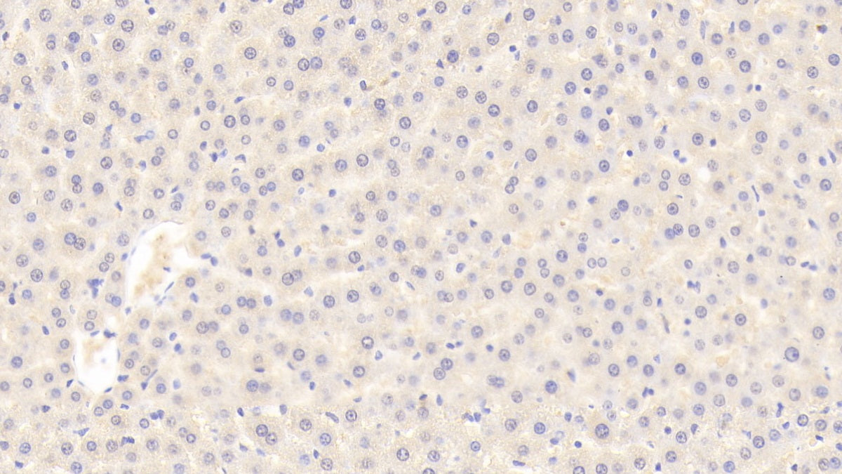 Serpin A10 (SERPINA10) Polyclonal Antibody - image 3