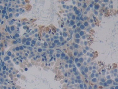Serpin A10 (SERPINA10) Polyclonal Antibody - image 5