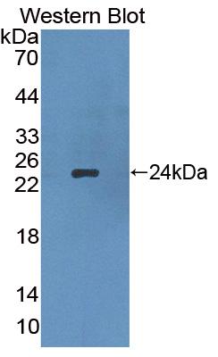 DAB staining on IHC-P; Samples: Rat Skin Tissue; Primary Ab: 20µg/ml Rabbit Anti-Rat APOB Antibody Second Ab: 2µg/mL HRP-Linked Caprine Anti-Rabbit IgG Polyclonal Antibody