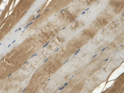 DAB staining on fromalin fixed paraffin- embedded kidney tissue)