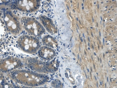Apolipoprotein B (APOB) Polyclonal Antibody - image 5