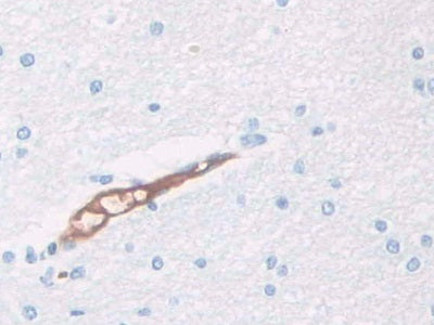 DAB staining on fromalin fixed paraffin- embedded kidney tissue)