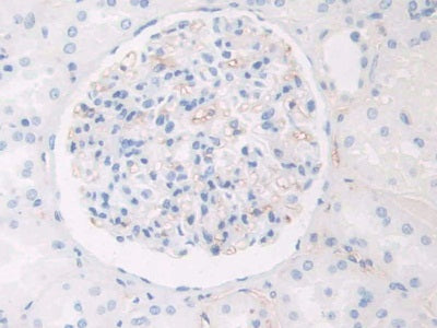 Haptoglobin Related Protein (HPR) Polyclonal Antibody - image 4