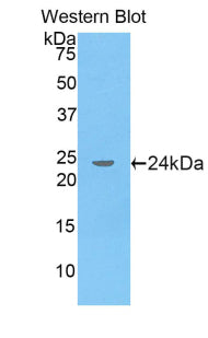 DAB staining on IHC-P; Samples: Rat Liver Tissue;  Primary Ab: 10μg/ml Rabbit Anti-Rat APOA5 Antibody Second Ab: 2µg/mL HRP-Linked Caprine Anti-Rabbit IgG Polyclonal Antibody