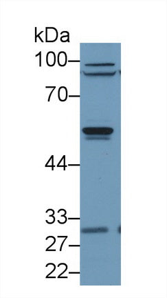 Western Blot; Sample: Recombinant protein.