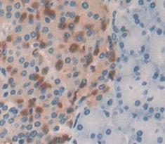 Arrestin Beta 2 (ARRb2) Polyclonal Antibody - image 4