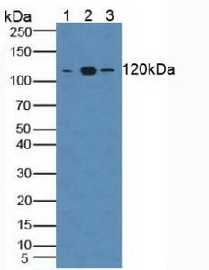 Western Blot; Sample: Recombinant TLR8, Human.