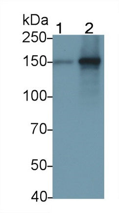 DAB staining on IHC-P; Samples: Human Colon Tissue; Primary Ab: 20μg/ml Rabbit Anti-Human TLR8 Antibody Second Ab: 2µg/mL HRP-Linked Caprine Anti-Rabbit IgG Polyclonal Antibody